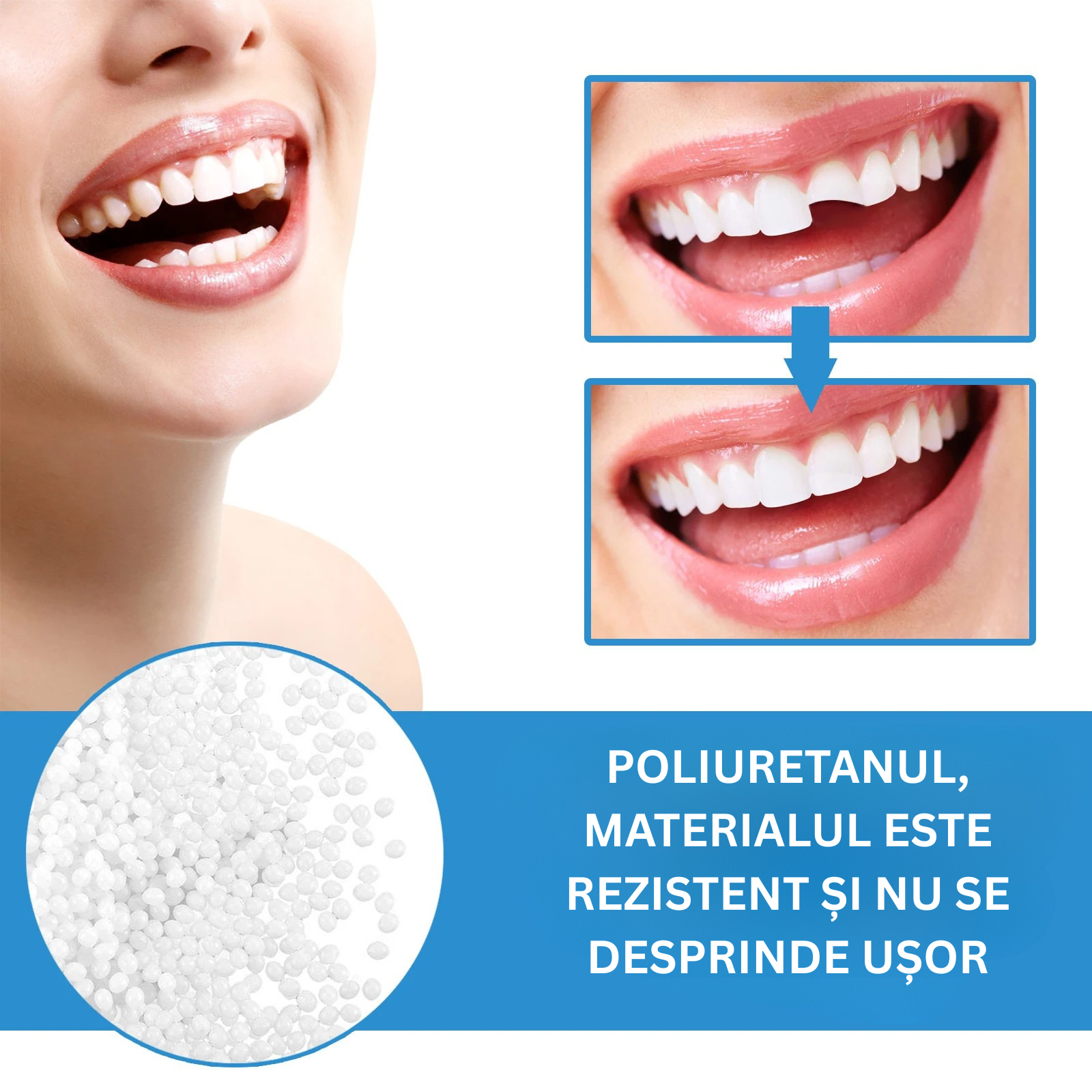 POLIURETANUL, MATERIALUL ESTE REZISTENT ȘI NU SE DESPRINDE UȘOR.png__PID:f2f9e26e-ce8e-4bd1-bab1-993b443cdd38